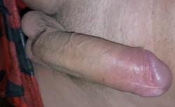 yyb_il7