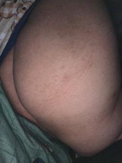 huesoroto picture